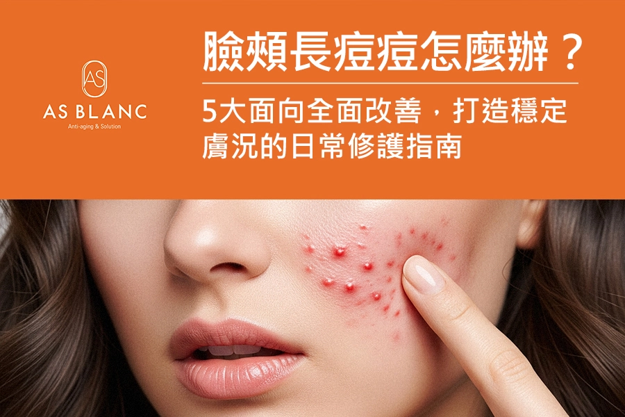 一位女性用食指指著左臉頰長痘痘的地方